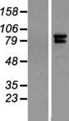 Western Blot: IQCE Overexpression Lysate (Adult Normal) [NBP2-05349] Left-Empty vector transfected control cell lysate (HEK293 cell lysate); Right -Over-expression Lysate for IQCE.