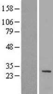 Western Blot: IQCF1 Overexpression Lysate (Adult Normal) [NBL1-12021] Left-Empty vector transfected control cell lysate (HEK293 cell lysate); Right -Over-expression Lysate for IQCF1.