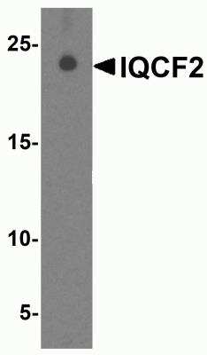 Western Blot: IQCF2 Antibody [NBP2-81922] - Analysis of IQCF2 in human testis tissue lysate with IQCF2 antibody at 1 ug/ml.