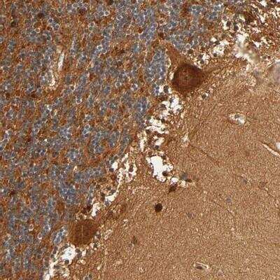 Immunohistochemistry: IQCJ-SCHIP1 Antibody [NBP1-90953] - Staining of human cerebellum shows strong cytoplasmic positivity in purkinje cells.