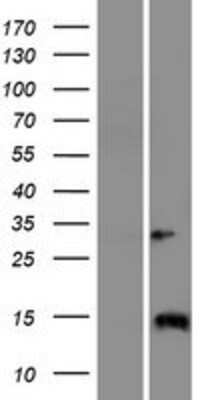 Western Blot IQCJ Overexpression Lysate