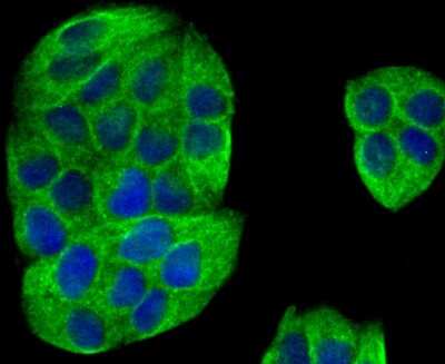 Immunocytochemistry/Immunofluorescence: IQGAP1 Antibody (JG38-74) [NBP2-75545] - Staining IQGAP1 in Hela cells (green). The nuclear counter stain is DAPI (blue). Cells were fixed in paraformaldehyde, permeabilised with 0.25% Triton X100/PBS.