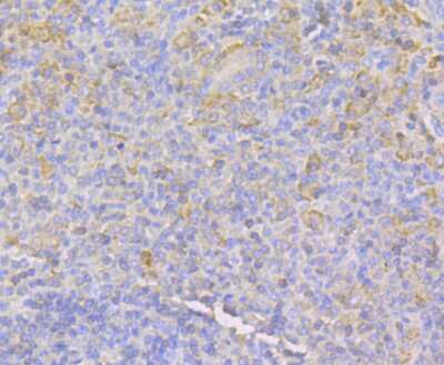 Immunohistochemistry-Paraffin: IQGAP1 Antibody (JG38-74) [NBP2-75545] - Analysis of paraffin-embedded human spleen tissue using anti-IQGAP1 antibody. Counter stained with hematoxylin.