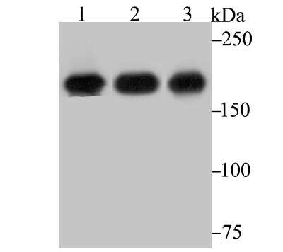 Western Blot: IQGAP1 Antibody (JG38-74) [NBP2-75545] - Analysis of IQGAP1 on different lysates using anti-IQGAP1 antibody at 1/1,000 dilution. Positive control: Lane 1: HUVEC Lane 2: A431 Lane 3: Mouse placenta