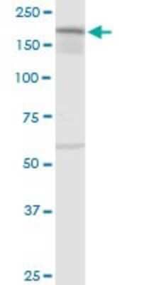 Western Blot: IQGAP3 Antibody [H00128239-D01P] - Analysis of IQGAP3 expression in A-431.