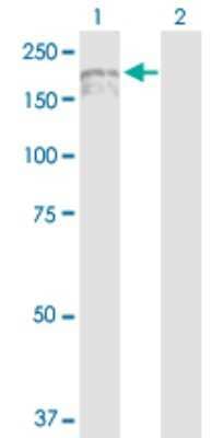 Western Blot: IQGAP3 Antibody [H00128239-D01P] - Analysis of IQGAP3 expression in transfected 293T cell line by IQGAP3 polyclonal antibody.Lane 1: IQGAP3 transfected lysate(184.60 KDa).Lane 2: Non-transfected lysate.