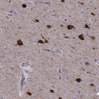 Immunohistochemistry-Paraffin IQM1 Antibody - BSA Free