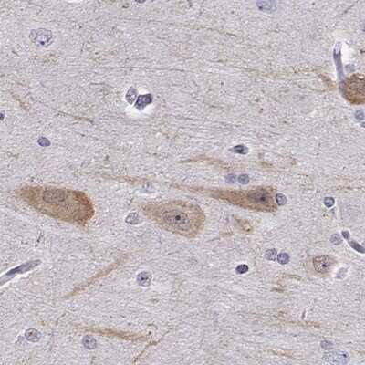 Immunohistochemistry-Paraffin IQM1 Antibody - BSA Free