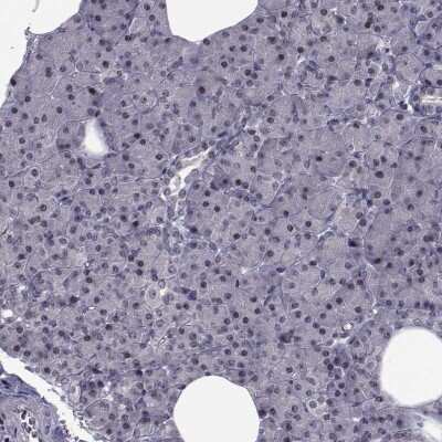 Immunohistochemistry-Paraffin IQM1 Antibody - BSA Free