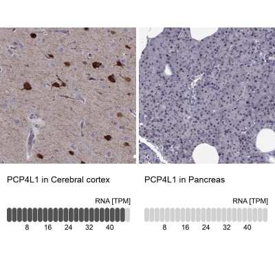Immunohistochemistry-Paraffin IQM1 Antibody - BSA Free