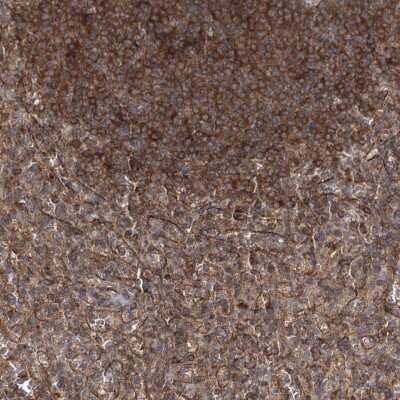 Immunohistochemistry-Paraffin: IQSEC1 Antibody [NBP2-32654] - Staining of human spleen shows cytoplasmic positivity in immune cells.