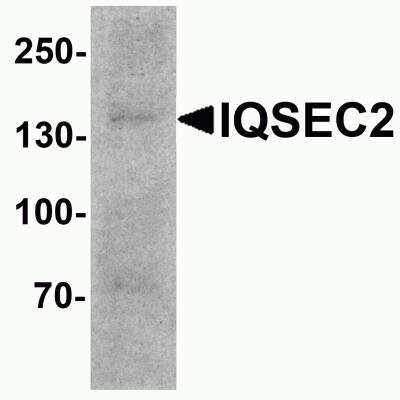 Western Blot IQSEC2 Antibody - BSA Free