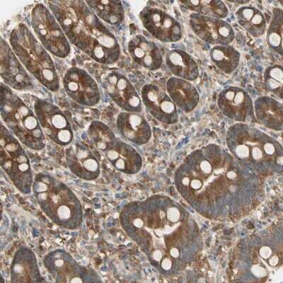 Immunohistochemistry-Paraffin IRAG Antibody