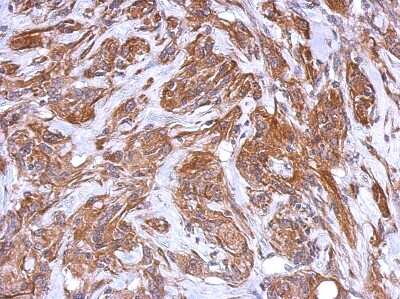 Immunohistochemistry-Paraffin: IRAG Antibody [NBP2-16987] - Analysis of paraffin-embedded U373 xenograft, using antibody at 1:500 dilution.