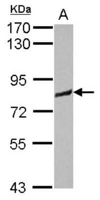 Western Blot: IRAG Antibody [NBP2-16987] - Sample (30 ug of whole cell lysate) A: MCF-7 7. 5% SDS PAGE gel, diluted at 1:1000.