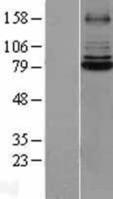 Western Blot IRAK1 Overexpression Lysate