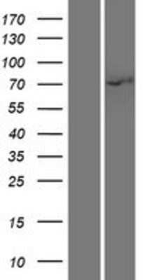 Western Blot: IRAK Overexpression Lysate (Adult Normal) [NBP2-11224] Left-Empty vector transfected control cell lysate (HEK293 cell lysate); Right -Over-expression Lysate for IRAK.