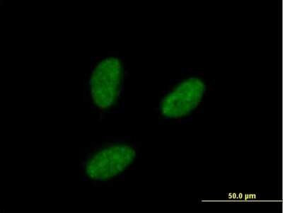 Immunocytochemistry/Immunofluorescence: IRAK1BP1 Antibody [H00134728-B01P] - Analysis of purified antibody to IRAK1BP1 on HeLa cell. (antibody concentration 20 ug/ml)