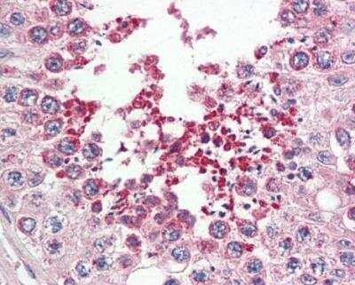 Immunohistochemistry-Paraffin: IRAK1BP1 Antibody [NBP1-31863] - Paraffin-embedded placenta. IRAK1BP1 antibody [N1C3] dilution: 1:100.