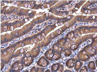Immunohistochemistry-Paraffin IRAK1BP1 Antibody - BSA Free
