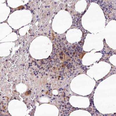Immunohistochemistry-Paraffin: IRAK1BP1 Antibody [NBP2-34019] - Staining of human bone marrow shows moderate to strong cytoplasmic positivity in hematopoietic cells.
