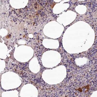 Immunohistochemistry-Paraffin: IRAK1BP1 Antibody [NBP2-34019] - Staining of human bone marrow shows moderate cytoplasmic positivity in megakaryocytes.