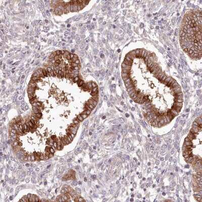 Immunohistochemistry-Paraffin: IRAK1BP1 Antibody [NBP2-34019] - Staining of human endometrium shows moderate to strong positivity in glandular cells.