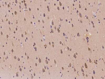 Immunohistochemistry-Paraffin: IRAK1BP1 Antibody [NBP2-97199] - Immunochemical staining of human IRAK1BP1 in human brain with rabbit polyclonal antibody at 1:100 dilution, formalin-fixed paraffin embedded sections.