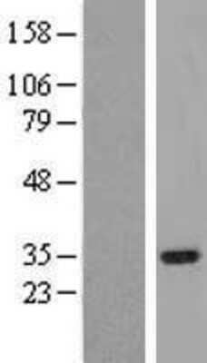 Western Blot: IRAK1BP1 Overexpression Lysate (Adult Normal) [NBP2-08760] Left-Empty vector transfected control cell lysate (HEK293 cell lysate); Right -Over-expression Lysate for IRAK1BP1.