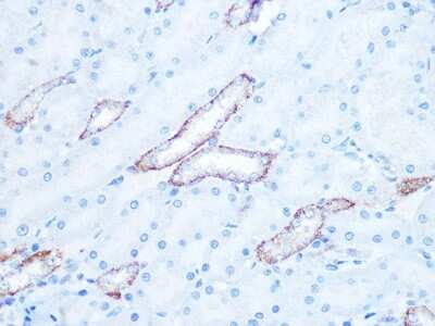 Immunohistochemistry-Paraffin: IRAK2 Antibody (10G3F8) [NBP3-16457] - Immunohistochemistry of paraffin-embedded rat kidney using IRAK2 Rabbit mAb (NBP3-16457) at dilution of 1:100 (40x lens).Perform microwave antigen retrieval with 10 mM PBS buffer pH 7.2 before commencing with IHC staining protocol.