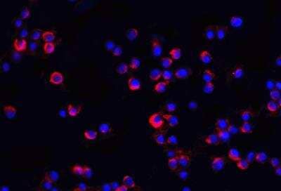 Immunocytochemistry/ Immunofluorescence IRAK2 Antibody - BSA Free