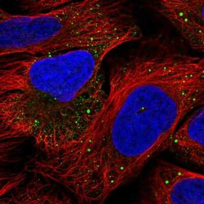 Immunocytochemistry/Immunofluorescence: IRAK2 Antibody [NBP2-38629] - Staining of human cell line U-2 OS shows localization to vesicles.