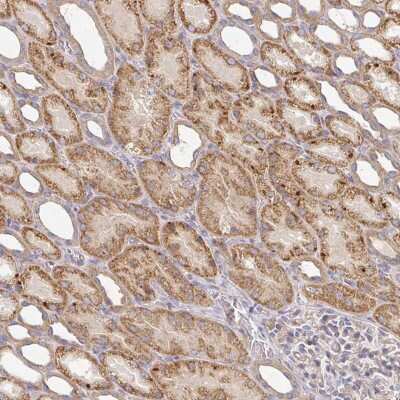 Immunohistochemistry: IRAK2 Antibody [NBP2-38629] - Staining of human kidney shows moderate cytoplasmic positivity in cells in tubules.