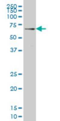 Western Blot: IRAK3 Antibody (1A6) [H00011213-M01] - IRAK3 monoclonal antibody (M01), clone 1A6 Analysis of IRAK3 expression in HeLa.