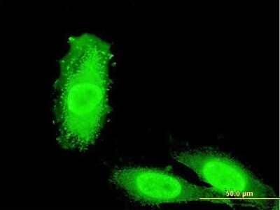 Immunocytochemistry/Immunofluorescence: IRAK3 Antibody (1C8) [H00011213-M06] - Analysis of monoclonal antibody to IRAK3 on HeLa cell. Antibody concentration 10 ug/ml