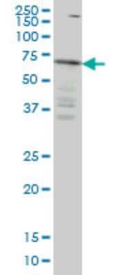 Western Blot: IRAK3 Antibody (1G11) [H00011213-M04] - Analysis of IRAK3 expression in HeLa (Cat # L013V1).