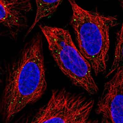 Immunocytochemistry/Immunofluorescence: IRAK3 Antibody [NBP1-83094] - Immunofluorescent staining of human cell line SiHa shows localization to vesicles.