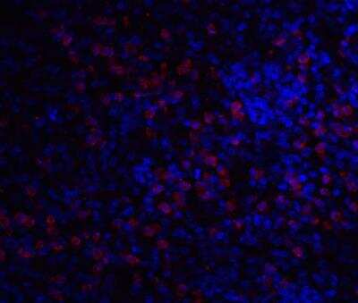 Immunocytochemistry/ Immunofluorescence IRAK3 Antibody - BSA Free