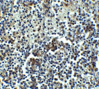 Immunohistochemistry-Paraffin IRAK3 Antibody - BSA Free