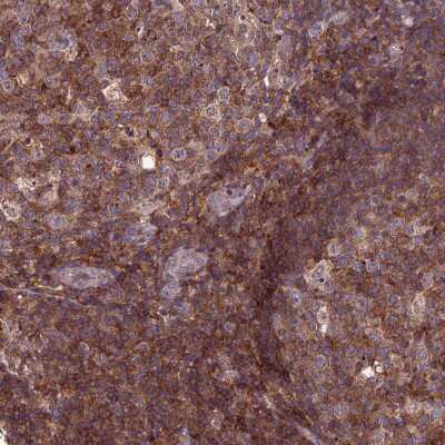 Immunohistochemistry-Paraffin IRAK3 Antibody