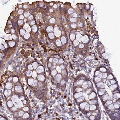 Immunohistochemistry-Paraffin IRAK3 Antibody