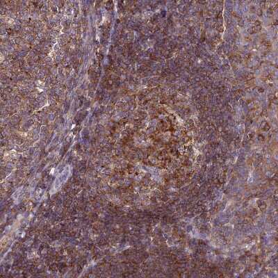 Immunohistochemistry-Paraffin: IRAK3 Antibody [NBP1-83094] - Staining of human tonsil shows strong cytoplasmic positivity in germinal and non germinal center cells.