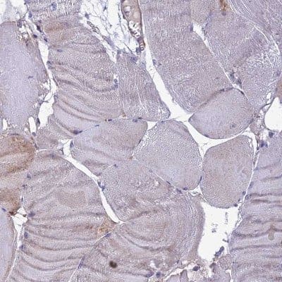 Immunohistochemistry-Paraffin: IRAK3 Antibody [NBP1-83094] - Staining of human skeletal muscle shows low positivity in myocytes as expected.