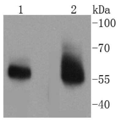 Western Blot: IRAK3 Antibody (SN64-07) [NBP2-67647] - Analysis of IRAKM on different lysates using anti-IRAKM antibody at 1/1,000 dilution. Positive control: Lane 1: Human placenta Lane 2: Human thyroid