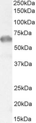 Western Blot: IRAK3 Antibody [NB100-96912] - Staining (0.1ug/ml) of Rat Liver lysate (35ug protein in RIPA buffer).  Detected with chemiluminescence.