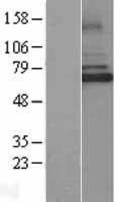 Western Blot IRAK3 Overexpression Lysate