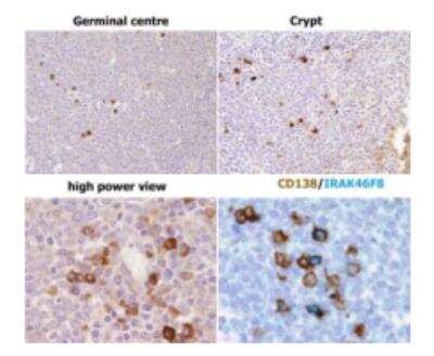 Immunohistochemistry: IRAK4 Antibody (6F8) [DDX0340P-100] - IHC staining of human FFPE tonsil section(Vermi William courtesy)