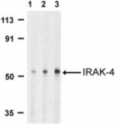 Western Blot: IRAK4 Antibody [NBP1-77231] - WB detection of IRAK4 protein in HeLa whole cell lysate using IRAK4 antibody using 1:1000 (lane 1), 1:500 (lane 2), and 1:250 (lane 3) dilutions respectively.