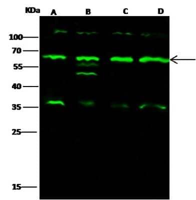 Western Blot: IRAK4 Antibody [NBP2-99534] - Anti-IRAK4 rabbit polyclonal antibody at 1:500 dilution. Lane A: A549 Whole Cell Lysate. Lane B: Hela Whole Cell Lysate. Lane C: K562 Whole Cell Lysate. Lane D: MCF7 Whole Cell Lysate. Lysates/proteins at 30 ug per lane. Secondary Goat Anti- Rabbit IgG H&L (Dylight 800) at 1/10000 dilution. Developed using the Odyssey technique. Performed under reducing conditions. Predicted band size: 51 kDa. Observed band size: 63 kDa (We are unsure as to the identity of these extra bands).