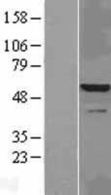 Western Blot IRAK4 Overexpression Lysate